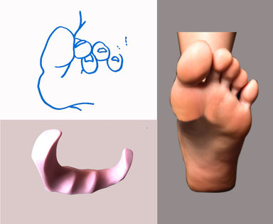 pedicure perpignan